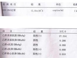 肝炎化验单