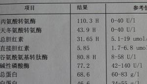 肝功能检查结果