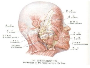 面神经瘫痪