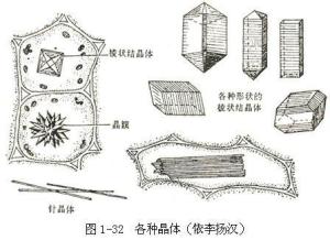 草酸钙结晶