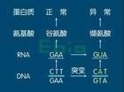 贫血症的病因图解