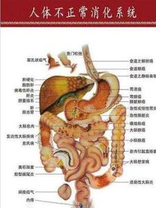 人体不正常的消化系统示意图