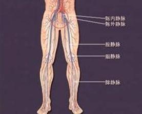 深静脉血栓形成