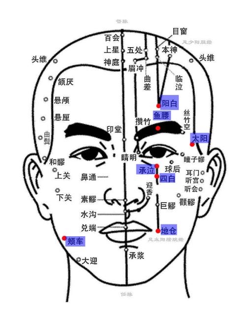 面瘫